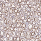 Immunohistochemical staining of human Kidney shows moderate cytoplasmic positivity in cells in tubules.