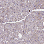 Immunohistochemical staining of human Pancreas shows very weak cytoplasmic positivity in exocrine glandular cells.