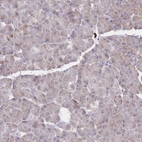 Immunohistochemical staining of human Pancreas shows very weak cytoplasmic positivity in exocrine glandular cells.