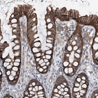Anti-GPR142 Antibody