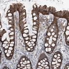 Anti-GPR142 Antibody