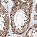 Anti-DUSP22 Antibody