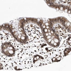 Immunohistochemical staining of human colon shows moderate to strong cytoplasmic positivity in glandular cells.