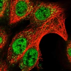 Immunofluorescent staining of human cell line A-431 shows localization to nucleoplasm & vesicles.