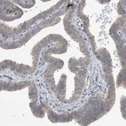 Immunohistochemical staining of human fallopian tube shows moderate to strong cytoplasmic positivity in glandular cells.