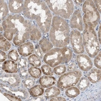 Immunohistochemical staining of human kidney shows moderate to strong cytoplasmic positivity in cells in tubules.