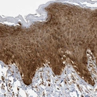 Immunohistochemical staining of human skin shows moderate to strong cytoplasmic positivity in epidermal cells.