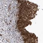 Anti-LAPTM4A Antibody