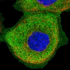 Immunofluorescent staining of human cell line A-431 shows localization to plasma membrane & cytosol.