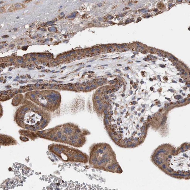 Anti-WFDC1 Antibody