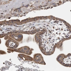 Anti-WFDC1 Antibody