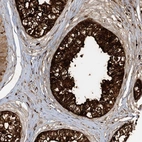 Immunohistochemical staining of human epididymis shows high expression.