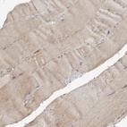 Immunohistochemical staining of human skeletal muscle shows low expression as expected.