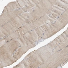 Immunohistochemical staining of human skeletal muscle shows low expression as expected.