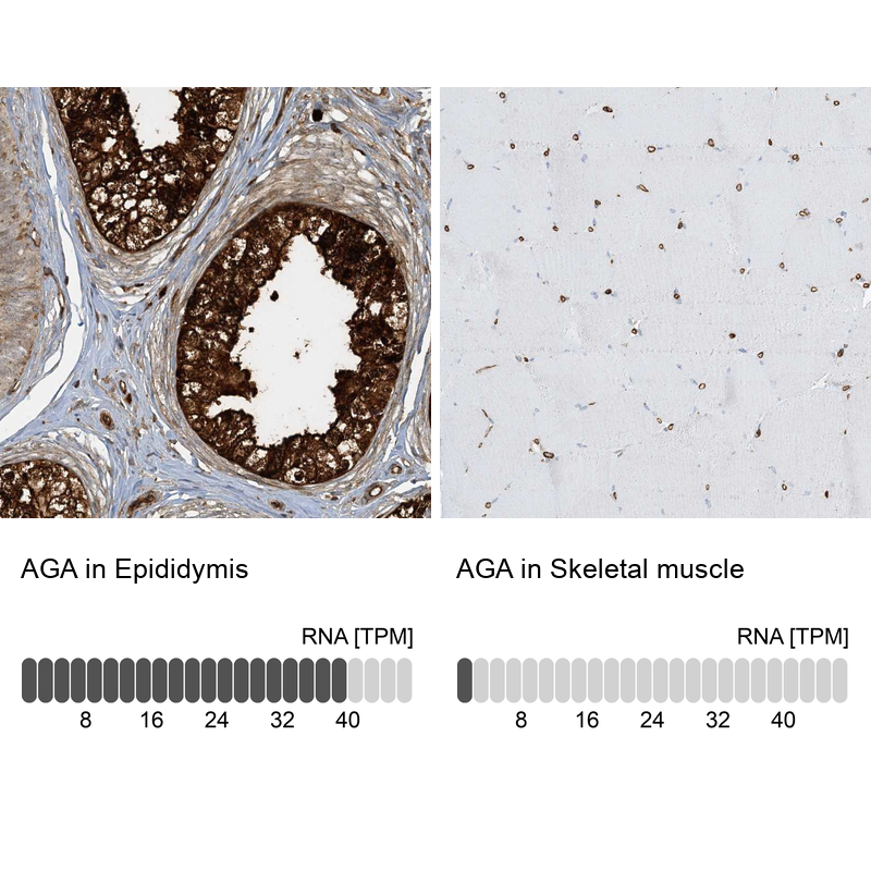 Anti-AGA Antibody
