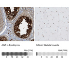 Anti-AGA Antibody