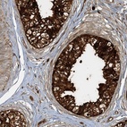 Immunohistochemical staining of human epididymis shows high expression.