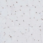 Immunohistochemical staining of human skeletal muscle shows low expression as expected.