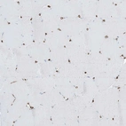 Immunohistochemical staining of human skeletal muscle shows low expression as expected.