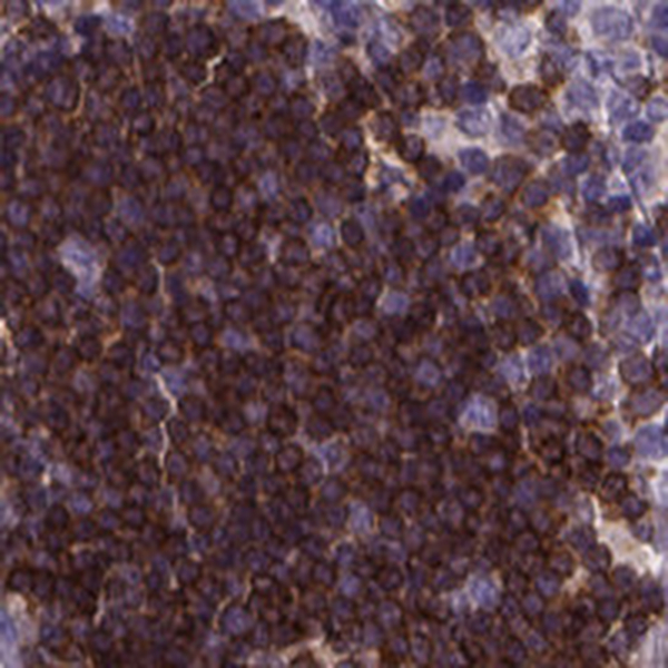 Anti-THEMIS Antibody