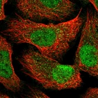 Immunofluorescent staining of human cell line U-2 OS shows localization to nucleoplasm & vesicles.