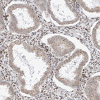 Anti-ZNF512 Antibody