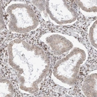 Anti-ZNF512 Antibody
