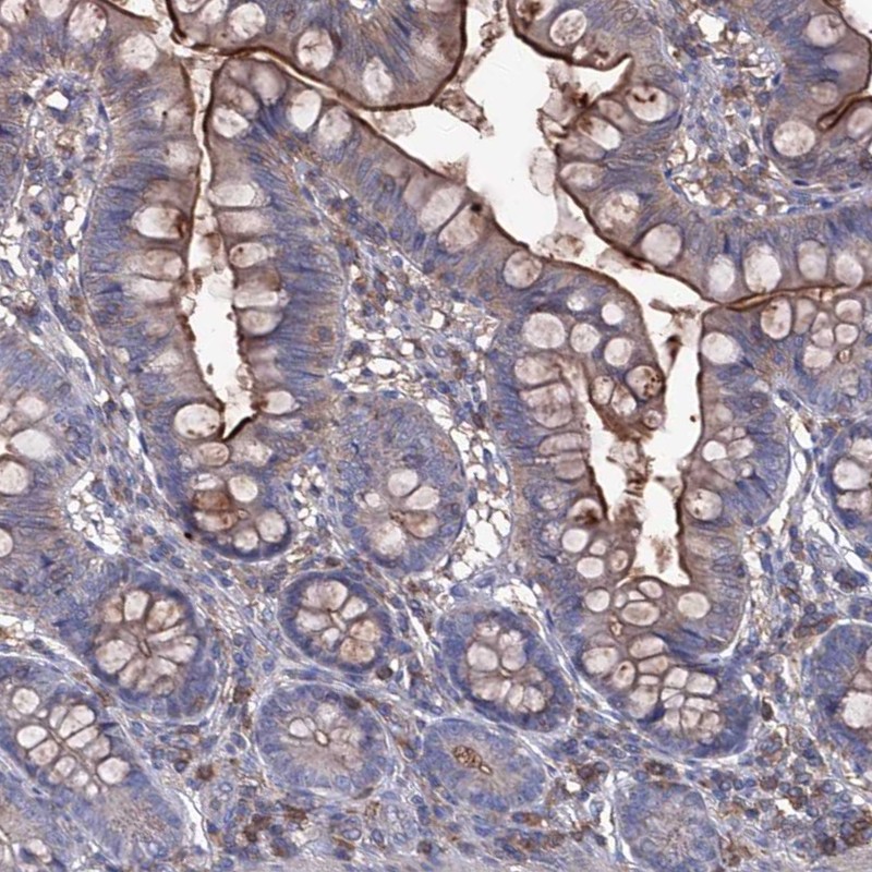 Anti-EPHA8 Antibody