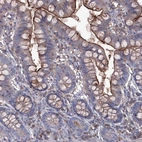 Anti-EPHA8 Antibody