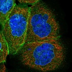 Immunofluorescent staining of human cell line A-431 shows localization to nuclear membrane & plasma membrane.