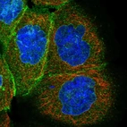 Immunofluorescent staining of human cell line A-431 shows localization to nuclear membrane & plasma membrane.