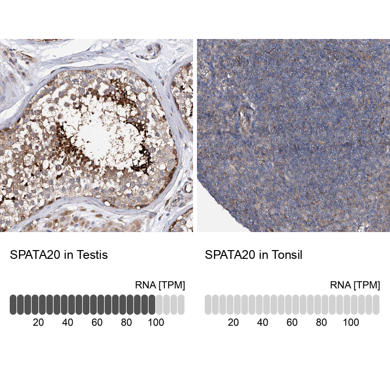 Anti-SPATA20 Antibody