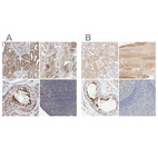 Immunohistochemical staining of human kidney, skeletal muscle, testis and tonsil using Anti-SPATA20 antibody HPA031442 (A) shows similar protein distribution across tissues to independent antibody HPA027144 (B).
