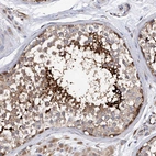 Immunohistochemical staining of human testis shows strong cytoplasmic positivity in spermatids.