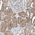 Immunohistochemical staining of human kidney shows strong cytoplasmic positivity in cells in tubules.