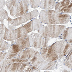 Immunohistochemical staining of human skeletal muscle shows moderate cytoplasmic positivity in myocytes.