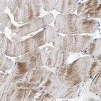 Immunohistochemical staining of human skeletal muscle shows moderate cytoplasmic positivity in myocytes.