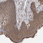 Immunohistochemical staining of human skin shows moderate cytoplasmic positivity in squamous epithelial cells.