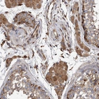 Immunohistochemical staining of human testis shows strong cytoplasmic positivity in Leydig cells.