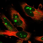 Immunofluorescent staining of human cell line U-251 MG shows localization to nucleoli.