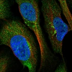 Immunofluorescent staining of human cell line U-2 OS shows localization to nucleoplasm, cytosol & the Golgi apparatus.