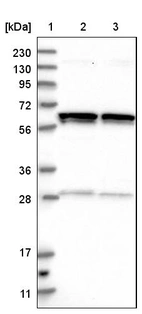 Anti-GLMN Antibody