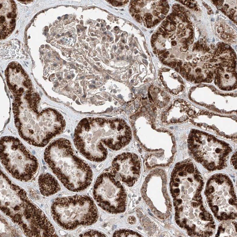 Anti-ZNF620 Antibody