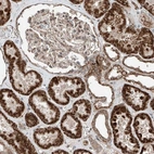 Anti-ZNF620 Antibody