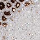 Immunohistochemical staining of human stomach shows strong cytoplasmic positivity in glandular cells.