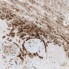 Immunohistochemical staining of human placenta shows strong cytoplasmic-membranous positivity in decidual cells.