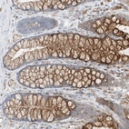 Immunohistochemical staining of human colon shows moderate cytoplasmic positivity in goblet cells and glandular cells.