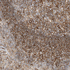 Anti-HLA-E Antibody