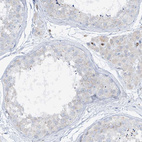 Anti-HLA-E Antibody