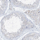 Immunohistochemical staining of human testis shows negative positivity in cells in seminiferous ducts as expected.